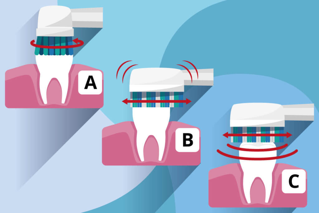 Grafik zu den drei Typen von elektrischen Zahnbuersten