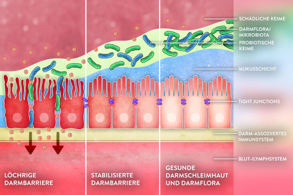 darstellung der darmflora dreigeteilt in geschädigt, heilend und gesund, zufuehrung von mikroorganismen durch probiotika