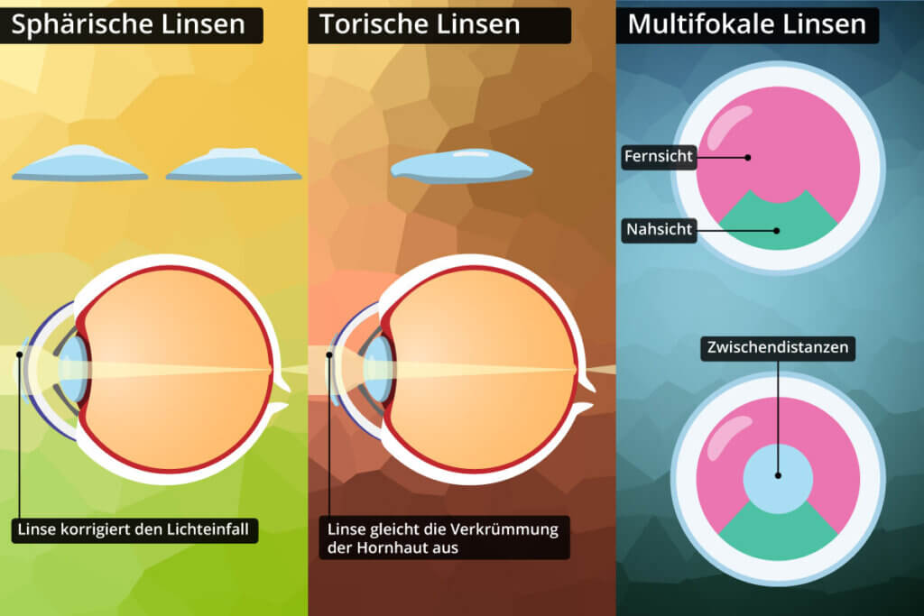 verschiedene Tageslinsen